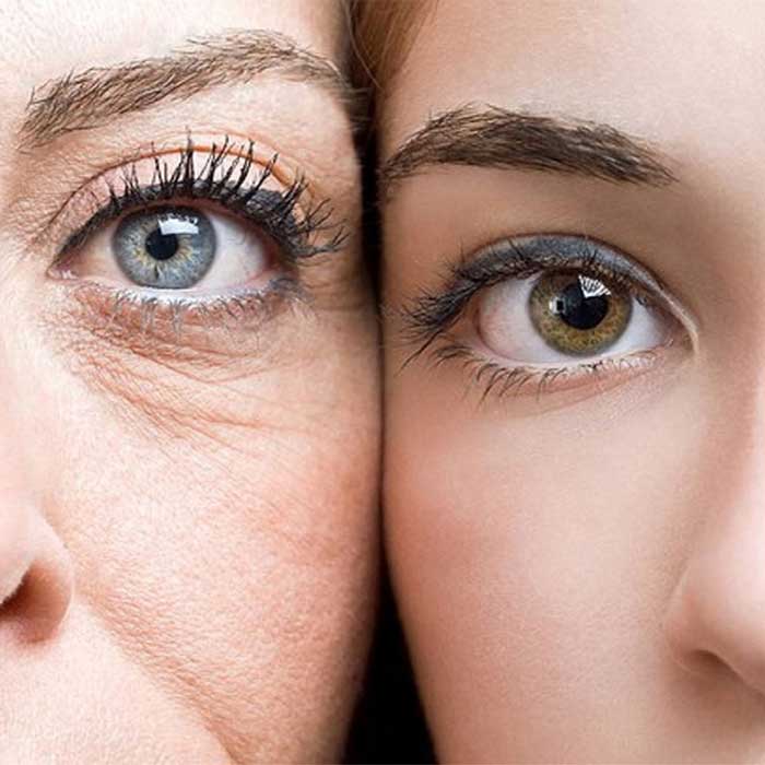بهترین کرم ضد چروک کدام است